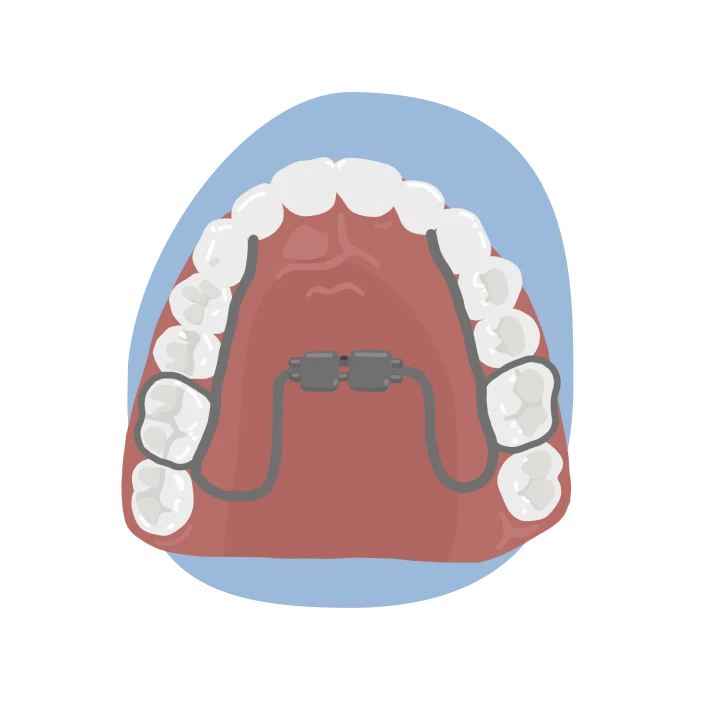 le guedard disjoncteur