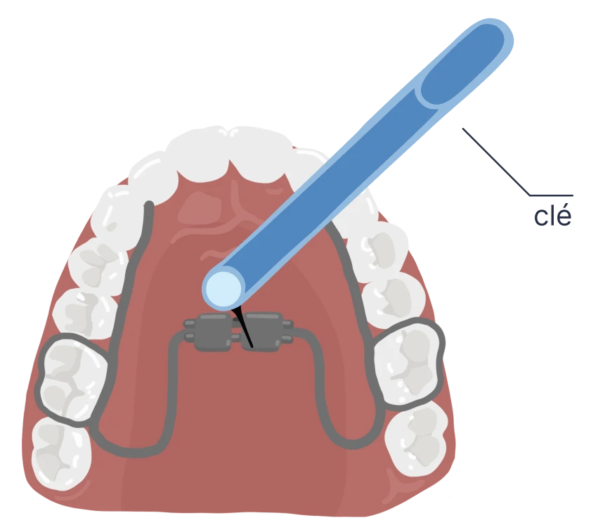 le guedard disjoncteur activation 2