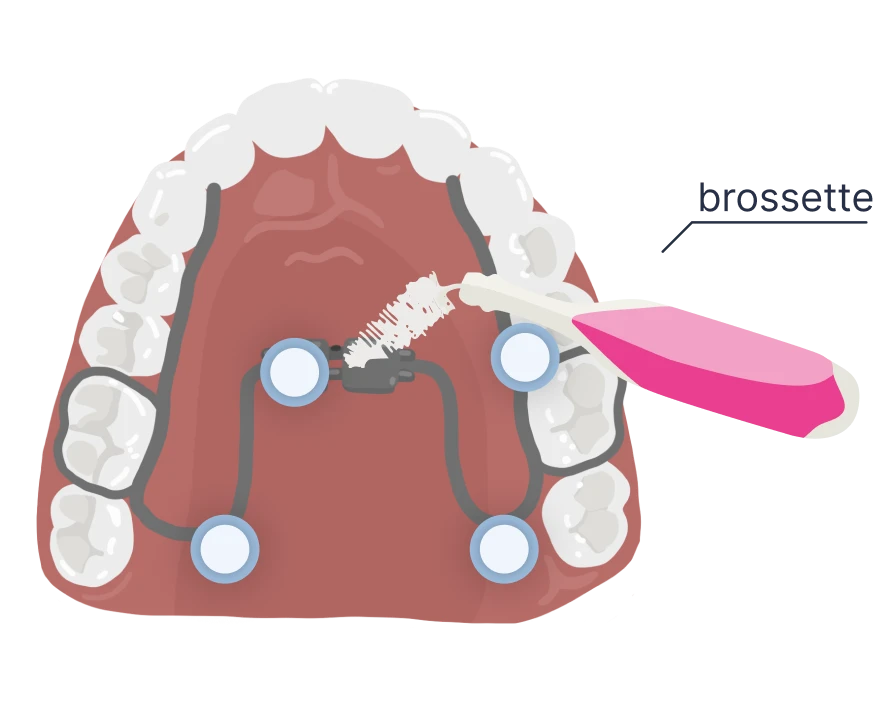 le guedard disjoncteur zone de brossage 2