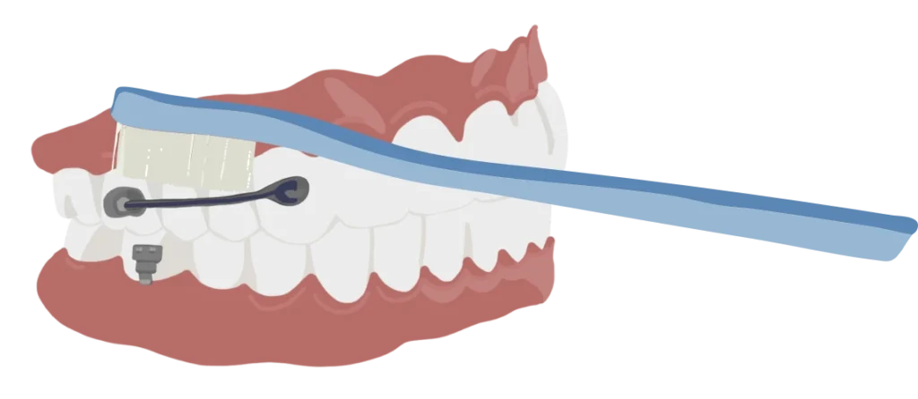 le guedard motion brossage 01