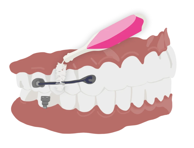 le guedard motion brossage 02