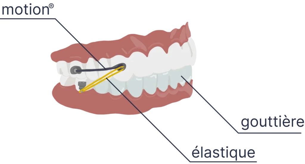 le guedard motion schema