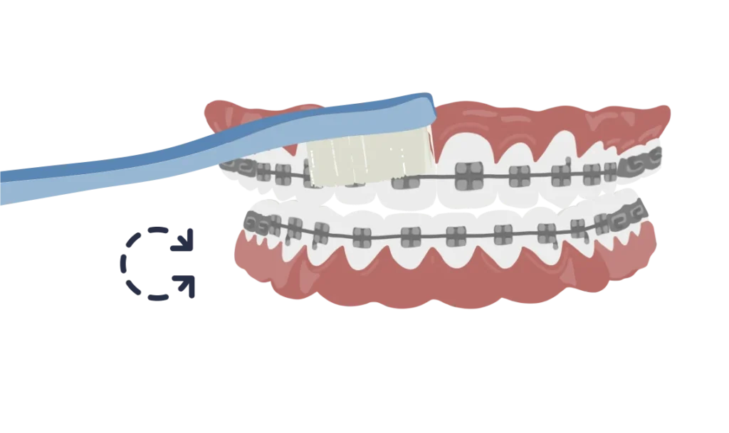 le guedard multibagues etape brossage brosse a dents 01