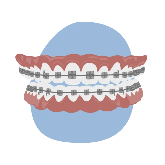 le guedard multibagues