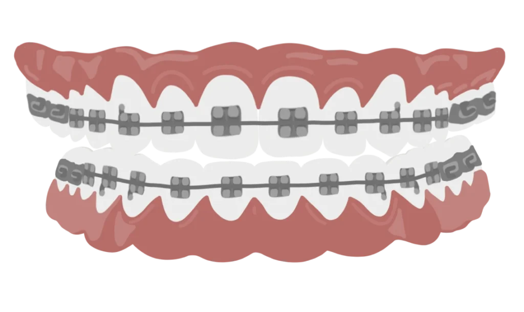 le guedard multibagues vue de face