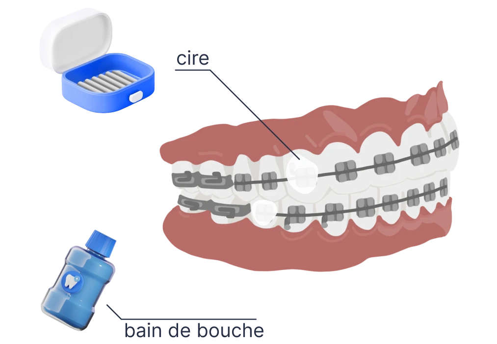 le guedard multibagues consignes periode adaptation