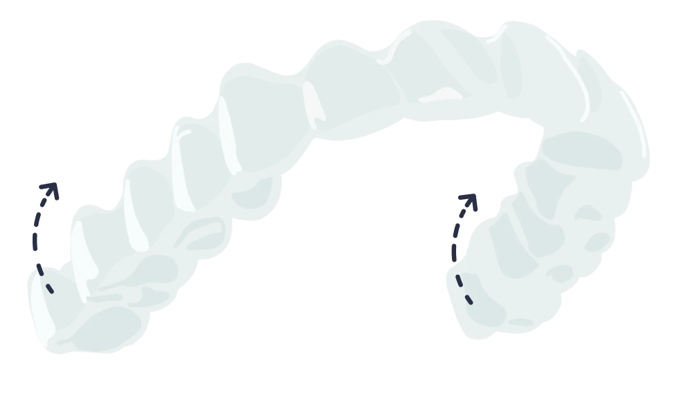 le guedard orthodontie rennes contention gouttieres mise en place 01