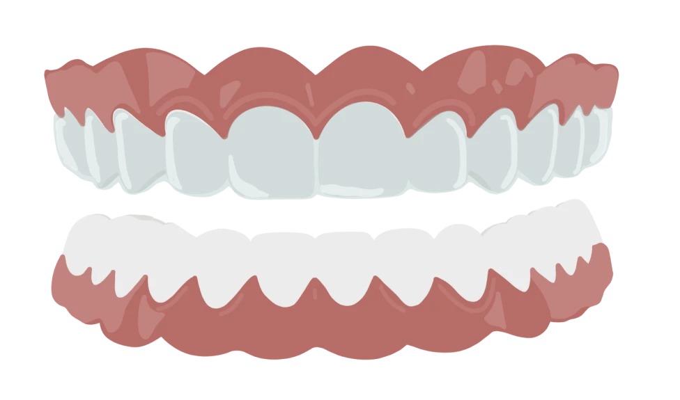 le guedard orthodontie rennes contention gouttieres portees