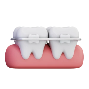 le guedard orthodontiste rennes fil de contention