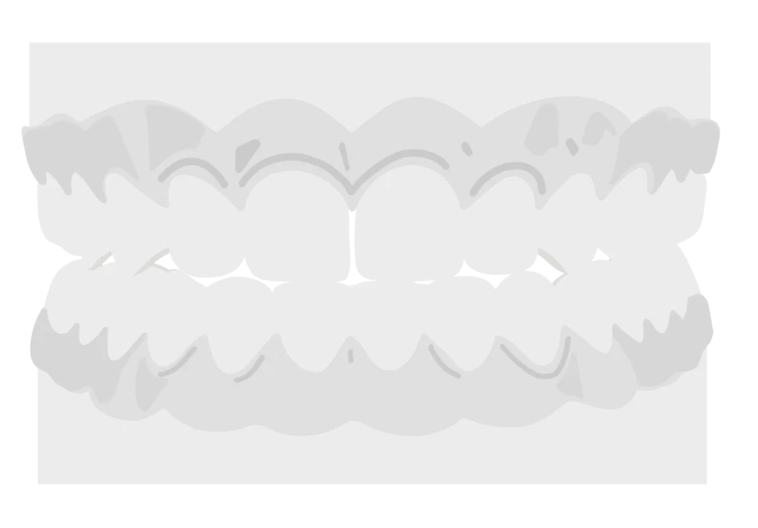 le guedard othodontiste saint gregoire appareil interception twin bloc moulage