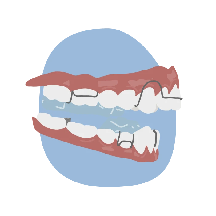 le guedard twin block